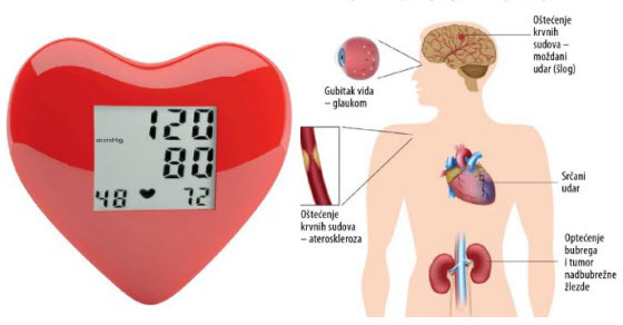 koji je normalni krvni tlak