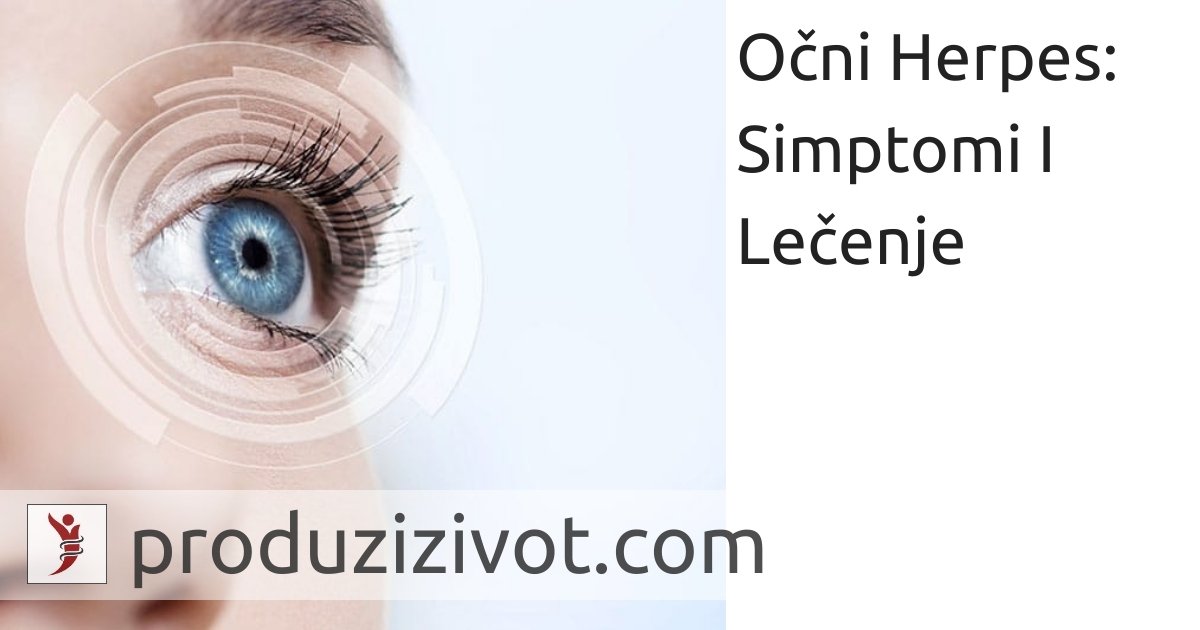 Očni Herpes: Simptomi I Lečenje; FOTO: https://www.ursapharm.de/en/products/ophthalmology/