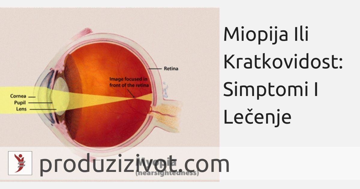 Miopija Ili Kratkovidost: Simptomi I Lečenje; FOTO: https://en.wikipedia.org/wiki/Near-sightedness