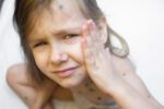 njena-cerka-(6)-ima-neobicnu-alergiju-i-moze-da-umre-u-svakom-trenutku:-hrabra-majka-sada-razmislja-da-napusti-zemlju,-jer-devojcica-reaguje-na-nesto-na-sta-smo-svi-navikli
