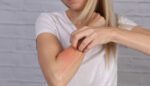 alergija-na-hranu-moze-da-bude-vrlo-opasna,-cak-i-smrtonosna:-ako-primetite-ovih-sest-simptoma,-odmah-uradite-test-na-toleranciju-hrane