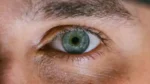 uveitis-–-koji-su-uzroci,-simptomi-i-lijecenje?