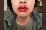 zelela-je-pune-usne-ali-se-ovome-nije-nadala:-trajna-sminka-joj-skroz-izdeformisala-lice