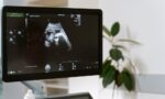 planiranje-trudnoce-–-buduce-mame,-prekontrolisite-svoje-zdravlje