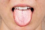 jezik-nikada-ne-sme-ovako-da-izgleda:-ako-primetite-ovo,-odmah-se-obratite-lekaru,-moze-ukazivati-na-bolesti