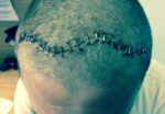 (foto)-nakon-sto-mu-je-majka-umrla-od-iste-bolesti,-ocu-dvoje-djece-dijagnosticiran-tumor-na-mozgu:-‘ovo-su-bili-prvi-simptomi’