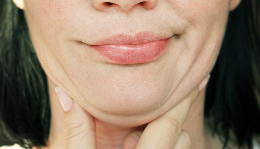 uz-ove-tri-vezbe-moguce-je-resiti-se-podbratka:-trener-otkriva-tajnu,-rezultati-su-brzo-vidljivi