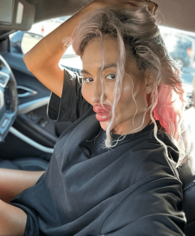 pre-i-posle:-zena-s-najvecim-jagodicama-na-svetu-pokazala-je-svoju-drasticnu-transformaciju