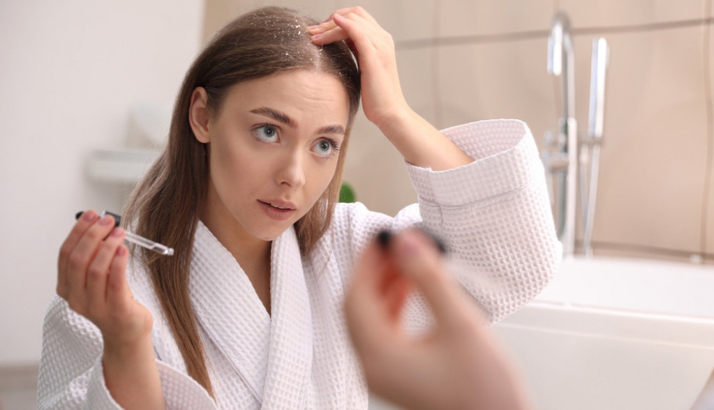 suva-koza-glave-je-vrlo-neprijatno-stanje:-evo-na-sta-morate-da-obratite-paznju-da-biste-oporavili-skalp