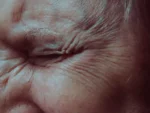 10-uobicajenih-ocnih-poremecaja-na-koje-trebate-obratiti-pozornost