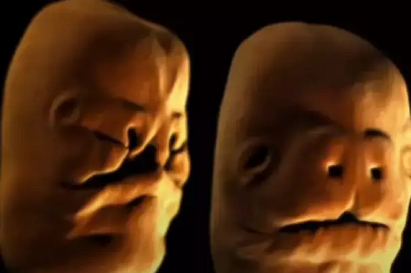 simulacija-razvoja-bebina-lica-u-maternici-izgleda-kao-horor:-mnogi-se-nisu-usudili-pogledati-do-kraja