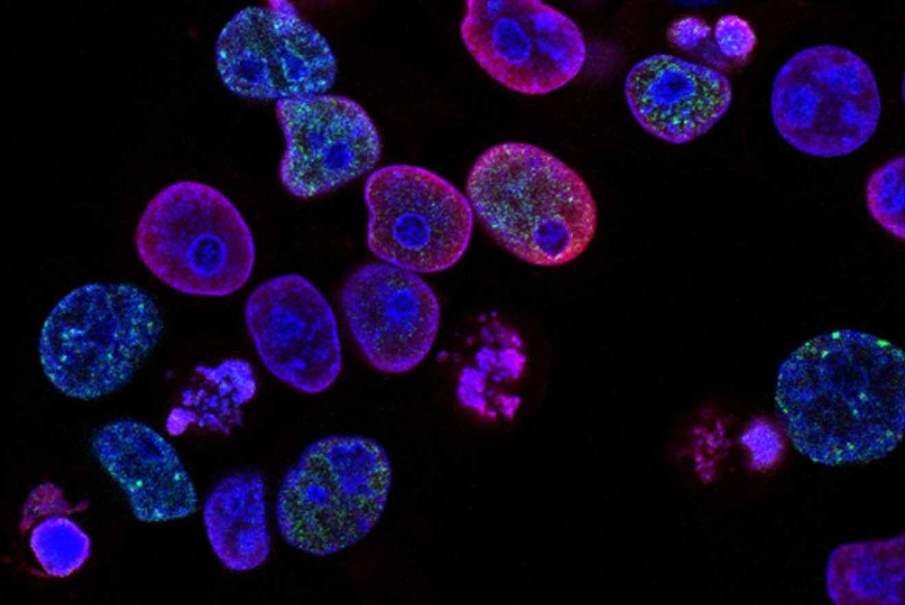 znanstvenici-navodno-pronasli-nacin-kako-ubiti-stanice-raka