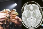 znanstvenici-otkrili-moze-li-se-mozak-oporaviti-od-alkohola:-rezultati-su-zapanjujuci